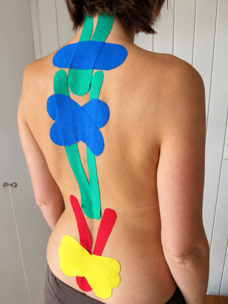 Kinesiotape am Rücken in Physiocare-Pflaumer in Schorndorf. Tape am Rücken